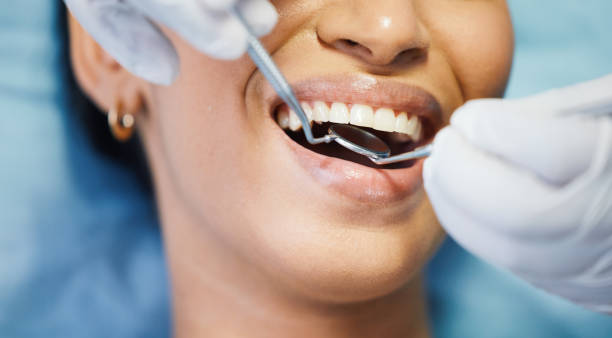 Best Emergency Tooth Extraction in Blackfoot, ID